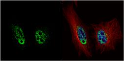 Anti-PRP19 antibody [C1C3] used in Immunocytochemistry/ Immunofluorescence (ICC/IF). GTX106952