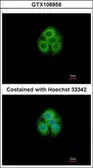 Anti-GLYATL1 antibody used in Immunocytochemistry/ Immunofluorescence (ICC/IF). GTX106956
