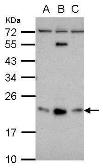 Anti-GLIPR1L1 antibody used in Western Blot (WB). GTX106972