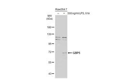 Anti-GBP5 antibody [N1N3] used in Western Blot (WB). GTX106994