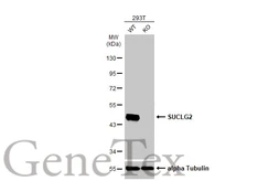 Anti-SUCLG2 antibody used in Western Blot (WB). GTX107002