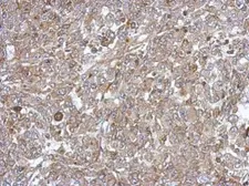 Anti-C18orf25 antibody used in IHC (Paraffin sections) (IHC-P). GTX107013