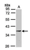Anti-BXDC1 antibody [N1C2] used in Western Blot (WB). GTX107021