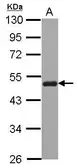 Anti-SNX5 antibody [N1C1] used in Western Blot (WB). GTX107045