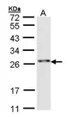 Anti-ZNF313 antibody [N1C3] used in Western Blot (WB). GTX107046