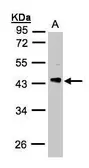 Anti-PHLP antibody used in Western Blot (WB). GTX107089