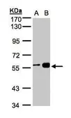 Anti-RCC2 antibody [N3C3] used in Western Blot (WB). GTX107094