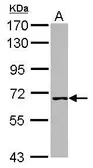 Anti-WHIP antibody [C1C3] used in Western Blot (WB). GTX107101
