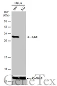 Anti-LXN antibody [N1C3] used in Western Blot (WB). GTX107116