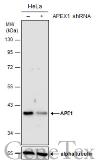 Anti-APE1 antibody used in Western Blot (WB). GTX107122