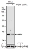 Anti-APE1 antibody used in Western Blot (WB). GTX107122