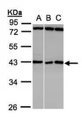 Anti-ASB5 antibody [N1C3] used in Western Blot (WB). GTX107132