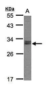 Anti-NSMCE1 antibody [N1C3] used in Western Blot (WB). GTX107136