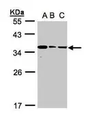 Anti-BPGM antibody [N1C3] used in Western Blot (WB). GTX107137