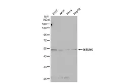 Anti-NSUN6 antibody [N3C3] used in Western Blot (WB). GTX107157