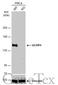 Anti-VCPIP1 antibody [C2C3], C-term used in Western Blot (WB). GTX107169