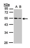 Anti-beta Tubulin antibody used in Western Blot (WB). GTX107175