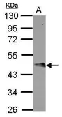 Anti-FBXO4 antibody used in Western Blot (WB). GTX107178