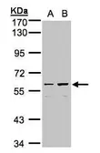 Anti-CCDC102B antibody [N3C3] used in Western Blot (WB). GTX107182