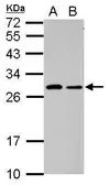 Anti-C1orf111 antibody used in Western Blot (WB). GTX107187