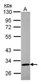 Anti-PARP11 antibody used in Western Blot (WB). GTX107210