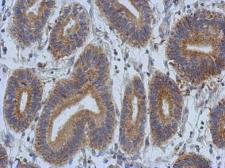 Anti-DCBLD2 antibody used in IHC (Paraffin sections) (IHC-P). GTX107215