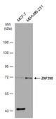 Anti-ZNF398 antibody [C1C3] used in Western Blot (WB). GTX107221