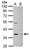 Anti-DHRS9 antibody [N1C3] used in Western Blot (WB). GTX107237