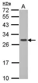 Anti-GIMAP6 antibody [N1C3] used in Western Blot (WB). GTX107241