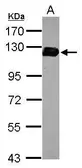 Anti-Drebrin antibody used in Western Blot (WB). GTX107270