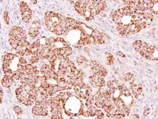 Anti-ALDH1B1 antibody used in IHC (Paraffin sections) (IHC-P). GTX107279