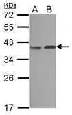 Anti-CA8 antibody [N1C3] used in Western Blot (WB). GTX107285