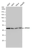 Anti-EIF4A1 antibody used in Western Blot (WB). GTX107319