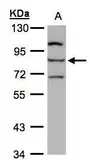 Anti-ALOXE3 antibody [N1N3] used in Western Blot (WB). GTX107325