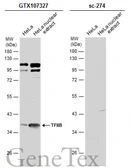 Anti-TFIIB antibody [N1C3] used in Western Blot (WB). GTX107327