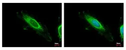 Anti-TBRG4 antibody used in Immunocytochemistry/ Immunofluorescence (ICC/IF). GTX107336