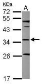 Anti-SCP2 antibody [N1C1] used in Western Blot (WB). GTX107339