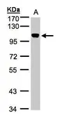 Anti-BRRN1 antibody used in Western Blot (WB). GTX107344