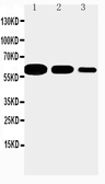 Anti-CD40 antibody used in Western Blot (WB). GTX10735