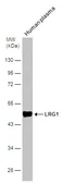 Anti-LRG1 antibody [N1C3] used in Western Blot (WB). GTX107355
