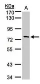 Anti-TTC30A antibody [C1C3] used in Western Blot (WB). GTX107359