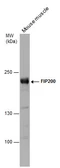 Anti-FIP200 antibody [N1N2], N-term used in Western Blot (WB). GTX107387