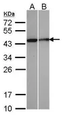 Anti-Selenophosphate synthetase 1 antibody used in Western Blot (WB). GTX107395