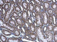 Anti-Acylglycerol kinase antibody used in IHC (Paraffin sections) (IHC-P). GTX107413