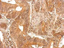 Anti-PAPSS1 antibody [N1C1] used in IHC (Paraffin sections) (IHC-P). GTX107427