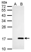 Anti-NME4 antibody used in Western Blot (WB). GTX107431