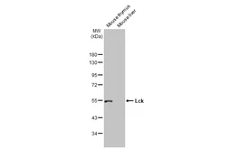 Anti-Lck antibody [N1C1] used in Western Blot (WB). GTX107432