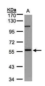 Anti-NEK3 antibody [N1C1] used in Western Blot (WB). GTX107436