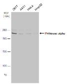 Anti-PI4 kinase alpha antibody [C1C2], Internal used in Western Blot (WB). GTX107441
