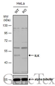 Anti-ILK antibody [N1C1-2] used in Western Blot (WB). GTX107443